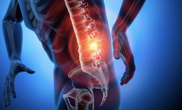 La lombalgie n’est pas une mince affaire.